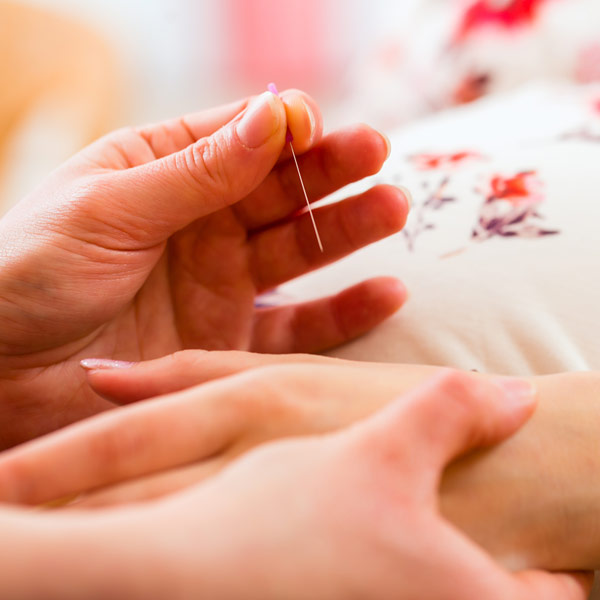 acupuncture