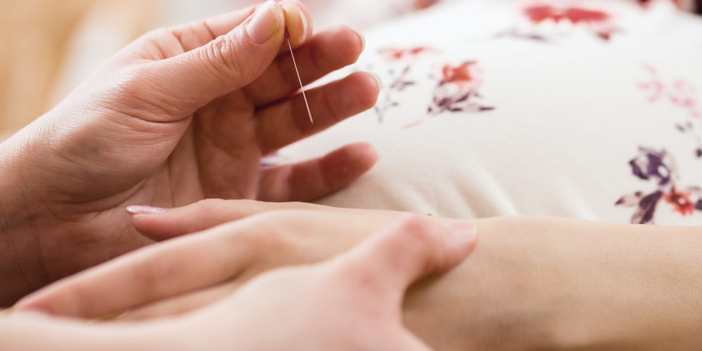 Women's health acupuncture